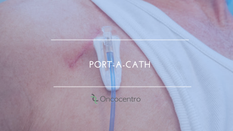 Port-A-Cath (Cateter totalmente implantado) | Oncocentro